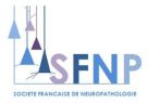 SFNP - Société Française de Neuropathologie